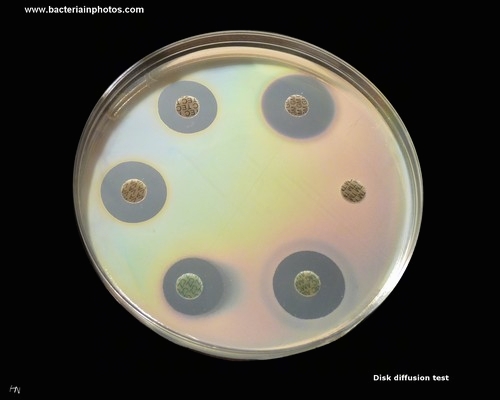 inhibition zones in antibiotic disks diffusion test